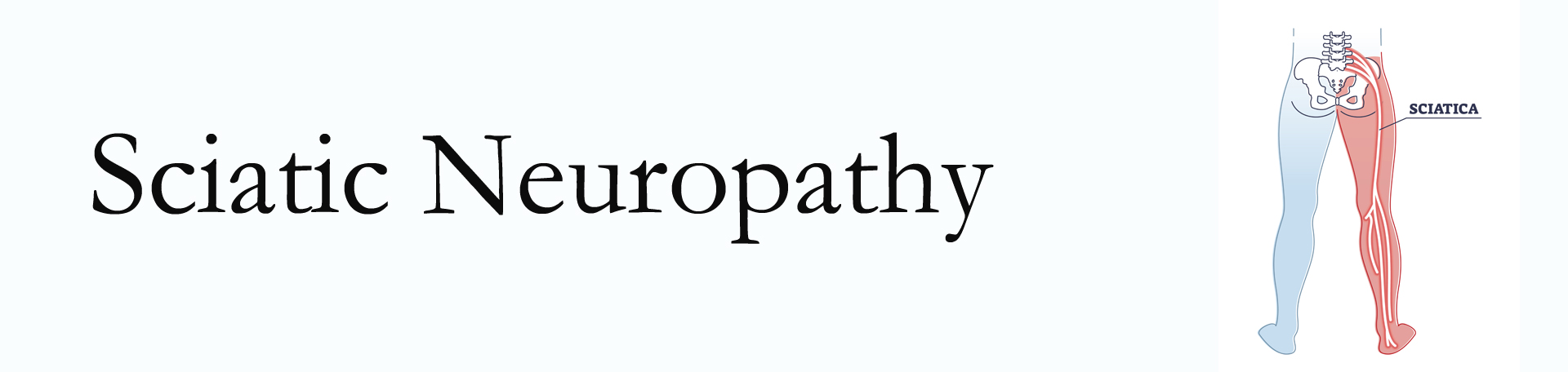Easley neuropathy pain (sciatica) 
