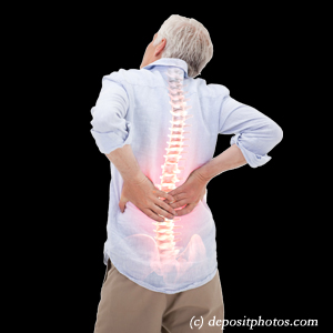 picture Easley back pain with lumbar spinal stenosis